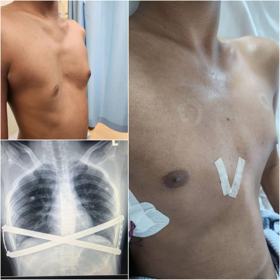 Dr. Balasubramoniam thoracic care 
